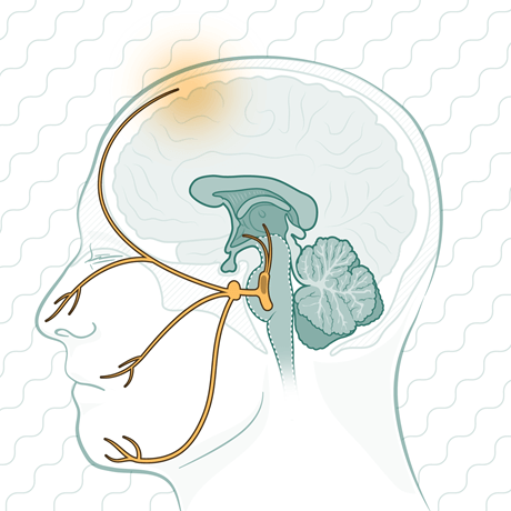 Headache Illustration