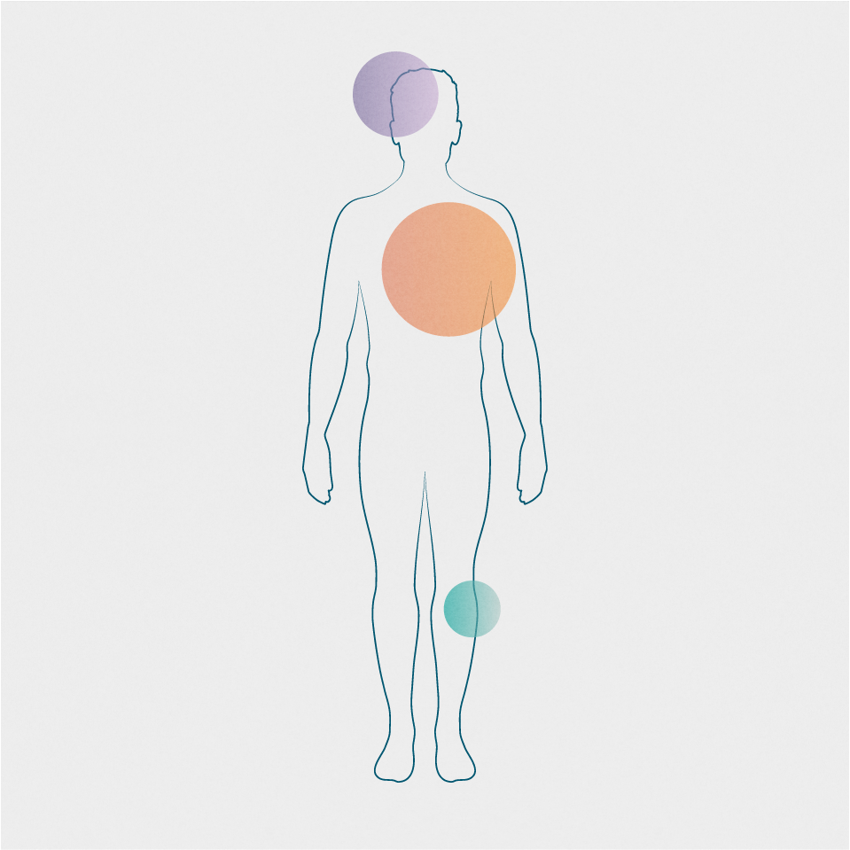 Migraine and comorbidities